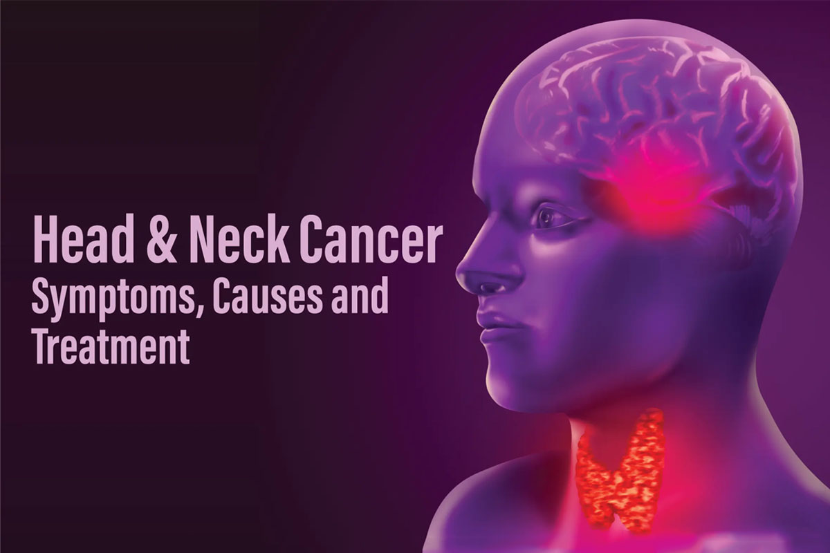 head-neck-cancer
