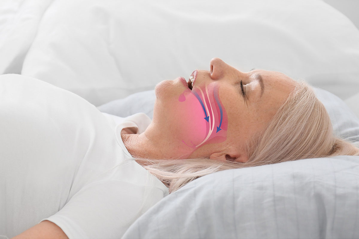 snoring-treatment
